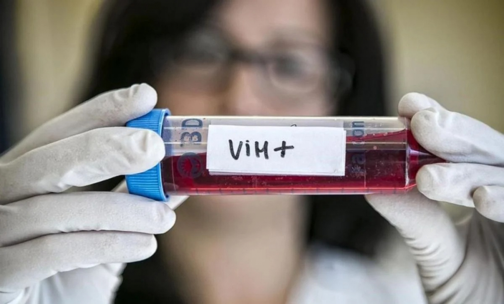 Aumento alarmante de VIH en el  Beni: 80 nuevos casos en solo 5 meses